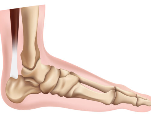Subtalar Joint Assessments & Treatments